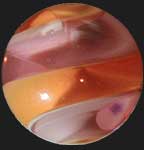 Ribbon Marble