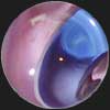 Ribbon Marble